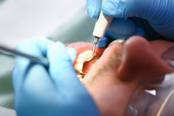 Best Emergency Treatment for Toothache in Amherst, OH