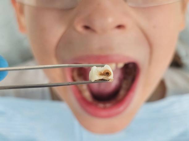 Best Pediatric Emergency Dentist in Amherst, OH